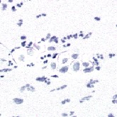 icm-counter-destained