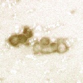 icm-icm-destained